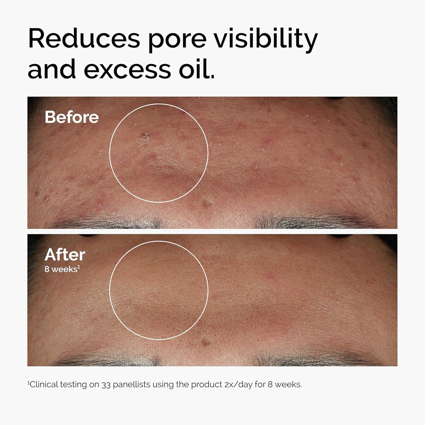Clear Skin Elixir™